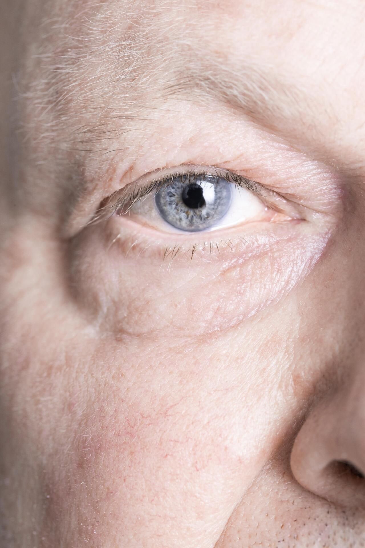 Muovinen mykiö on korvannut syntymässä saadun.