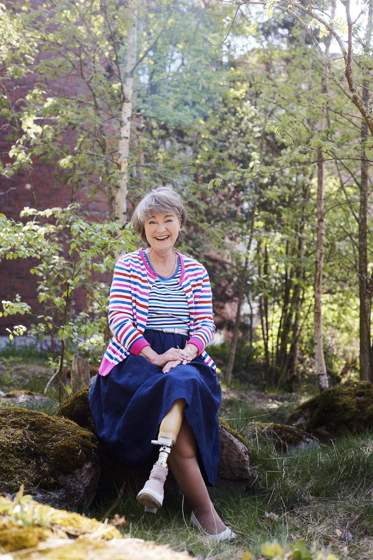 – Vasemman jalkani tilalla on titaaninen proteesi.