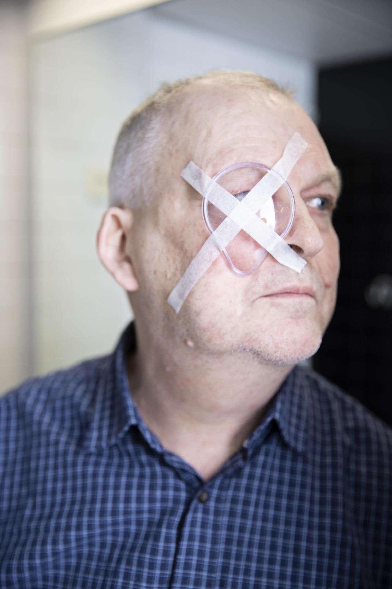 Leikattu silmä suojataan muovisella kilvellä.