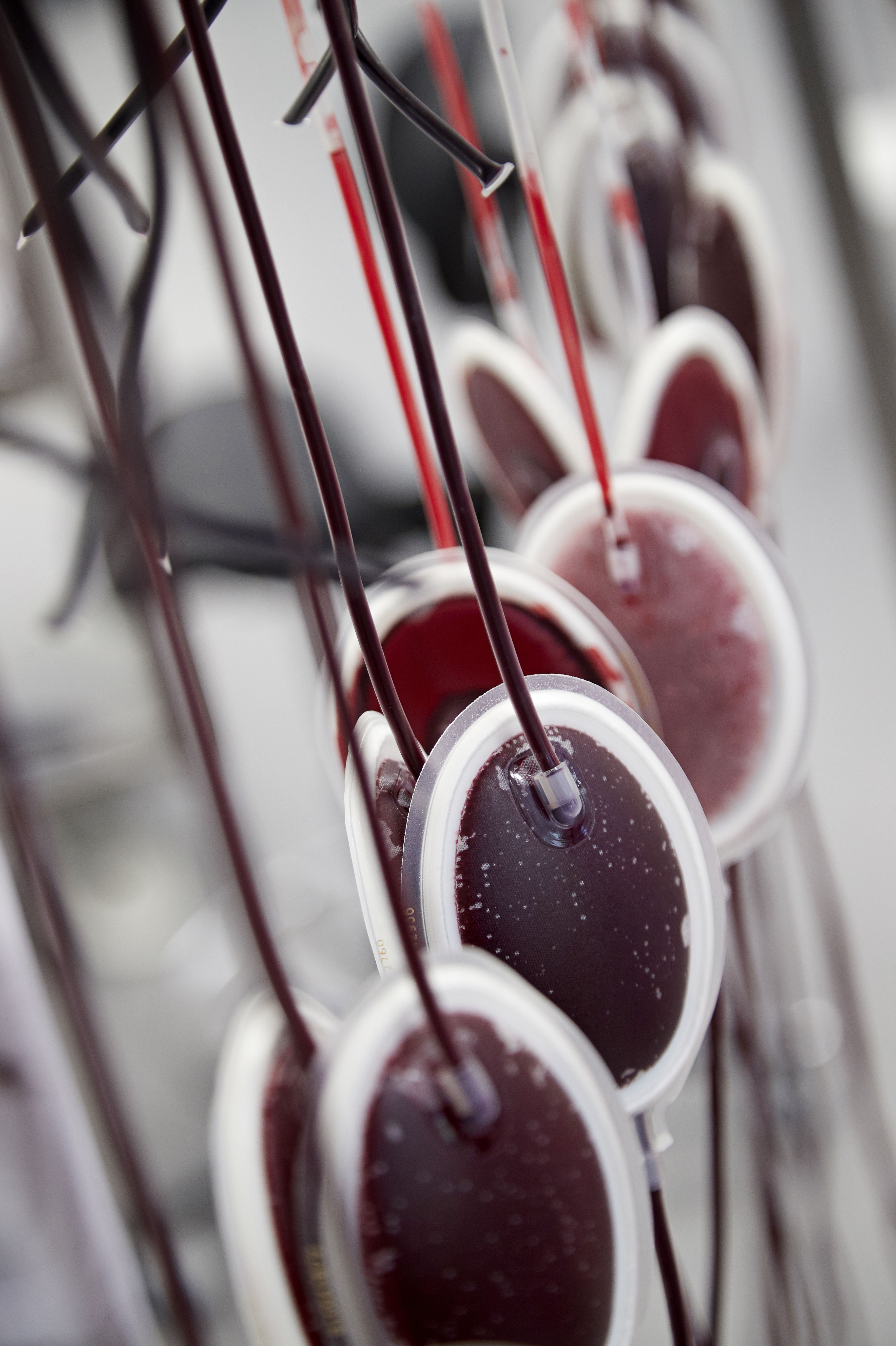 Suodatin poistaa valkosoluja punasolupusseista.